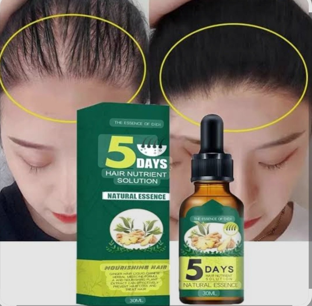 Eelhoe 5 Days Ginger Germinal Oil, (30ml) - Image 4