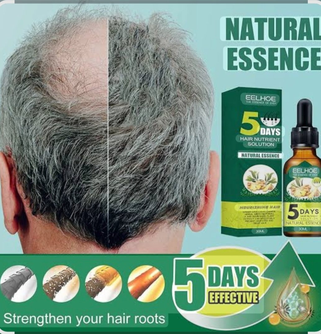 Eelhoe 5 Days Ginger Germinal Oil, (30ml) - Image 2