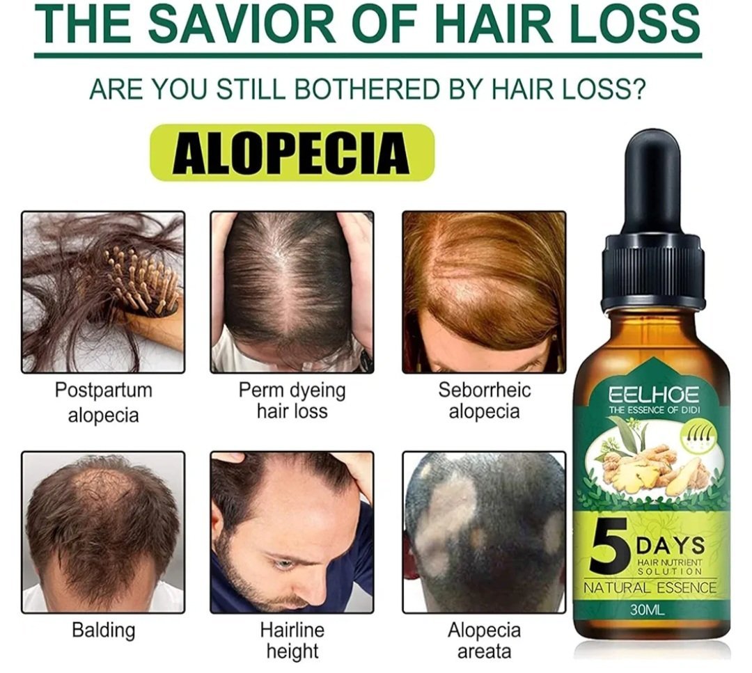 Eelhoe 5 Days Ginger Germinal Oil, (30ml) - Image 7